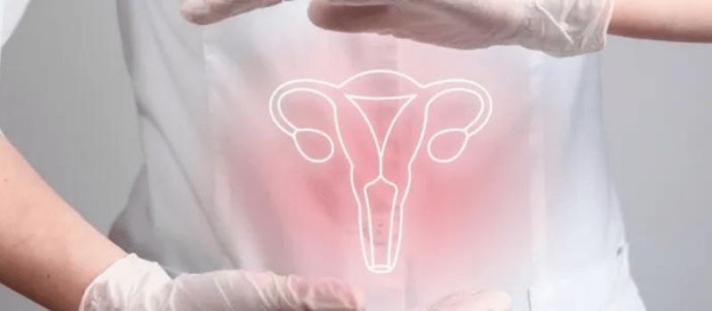 Fibroid 1 Fibroid 1